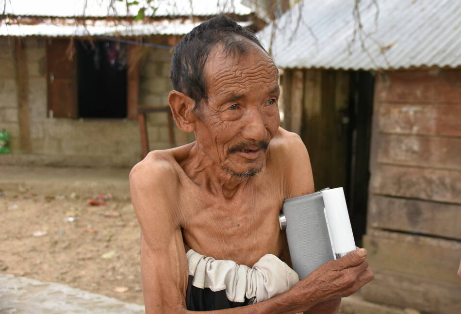 Homme mal-nourrie avec Tuberculose (Biman, 31.3.22)